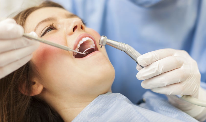 Dental implant illustration